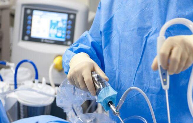 Laparoscopy