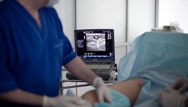 surgical treatment of varicoosis