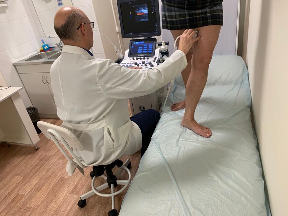 ultrasound diagnostics of varicose veins