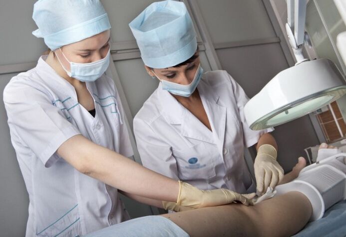 Surgery for varicose veins on the legs