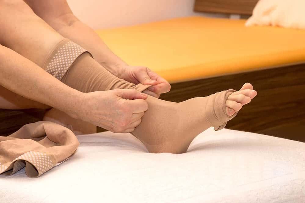 The use of compression stockings helps alleviate the manifestations of varicose veins. 